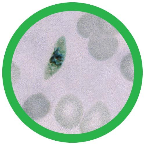 Malaria (Plasmodium Falciparum) GIANTmicrobe Plush