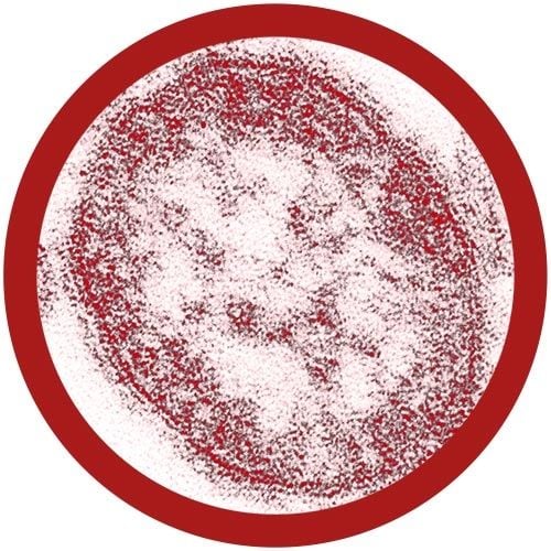 Measles (Morbillivirus)