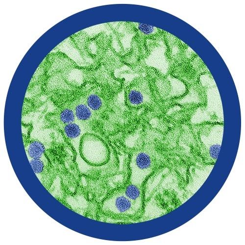 Zika (Zika Virus) GIANTmicrobe Plush
